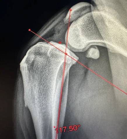 Pre-Operative-Radiograph